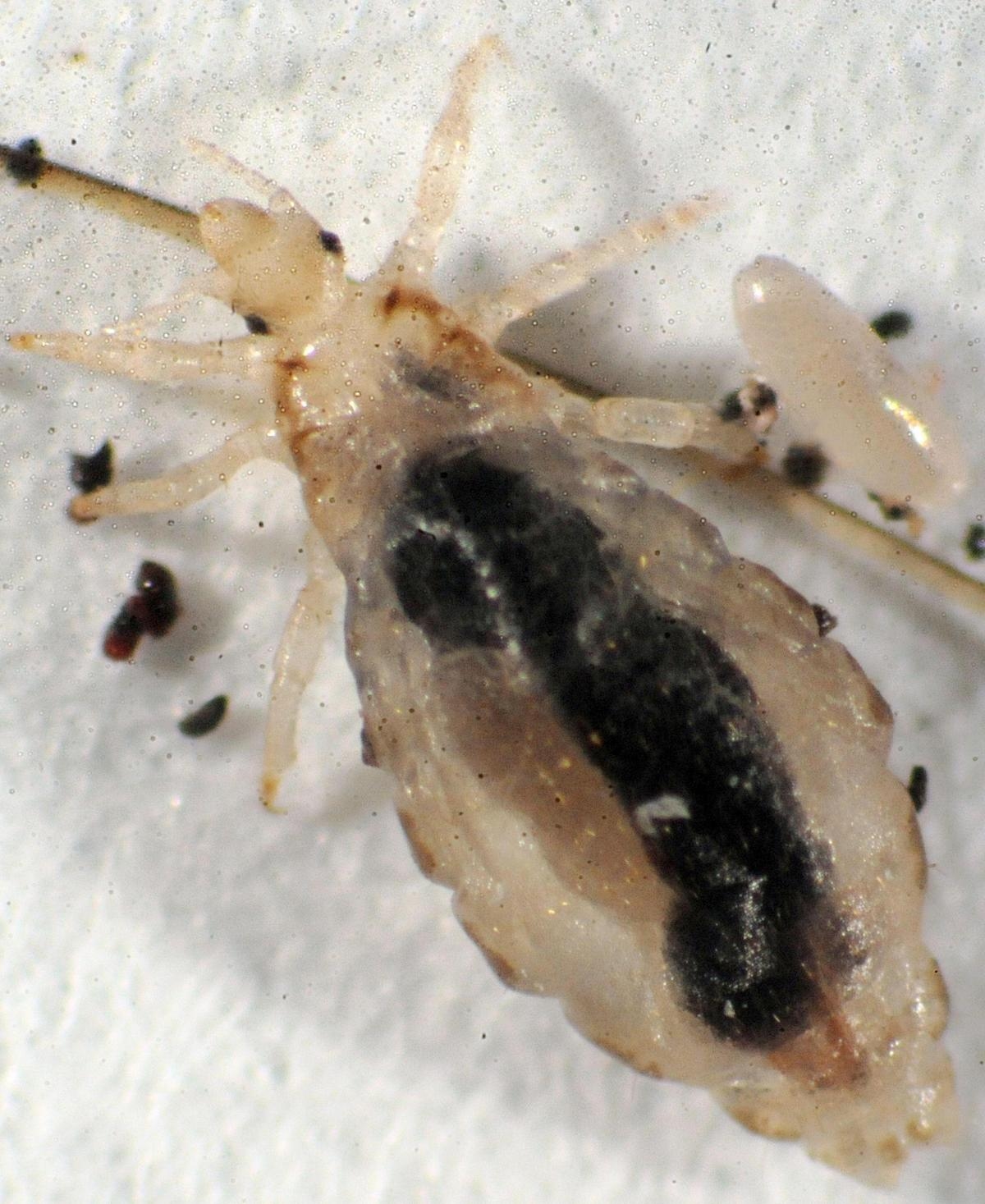Creature incredibili: i pidocchi sono molto meno carini dei gufi o dei gioielli